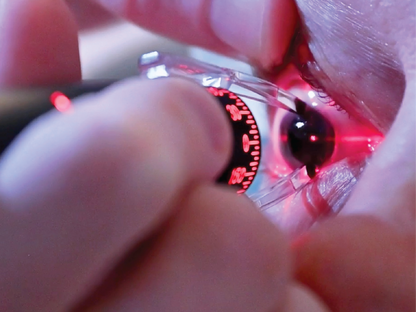 RoboMarker G2 - Surgeon to Procurement Approval Kit